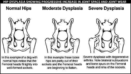What are the signs of hip dysplasia?