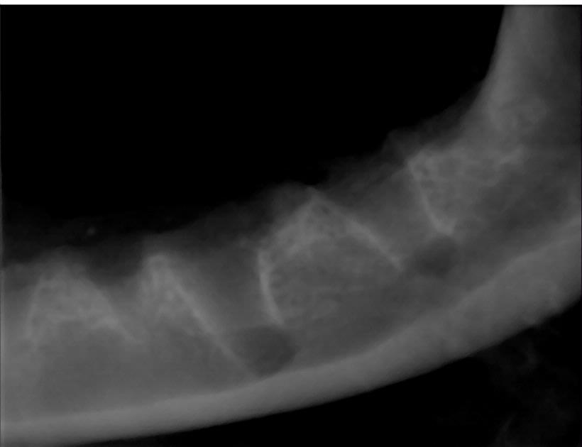 Dental X-ray Of A Dog Following An Extraction
