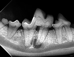 Preoperative Dental X-ray Showing Tooth Root Resporbtion