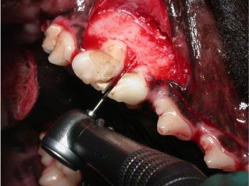 Sectioning Of A Tooth During Extraction Of A Dog's Premolar